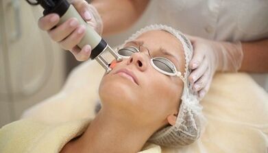 Tipos de rexuvenecemento facial fraccionado da pel